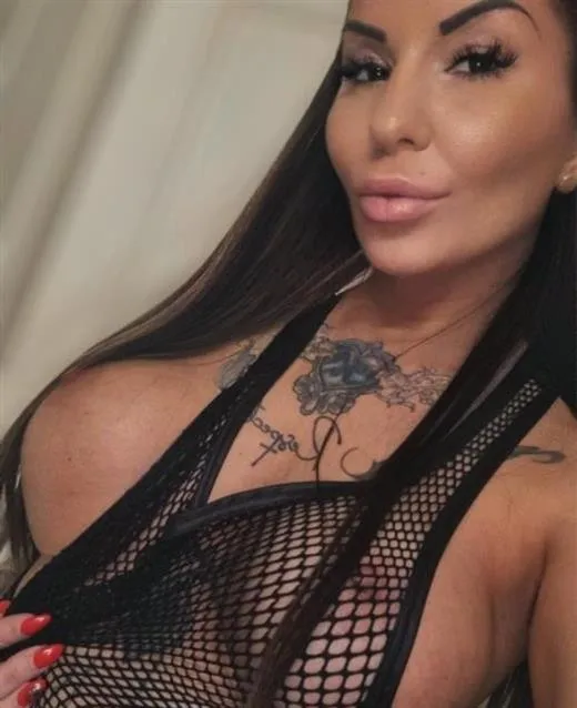 random escort 1